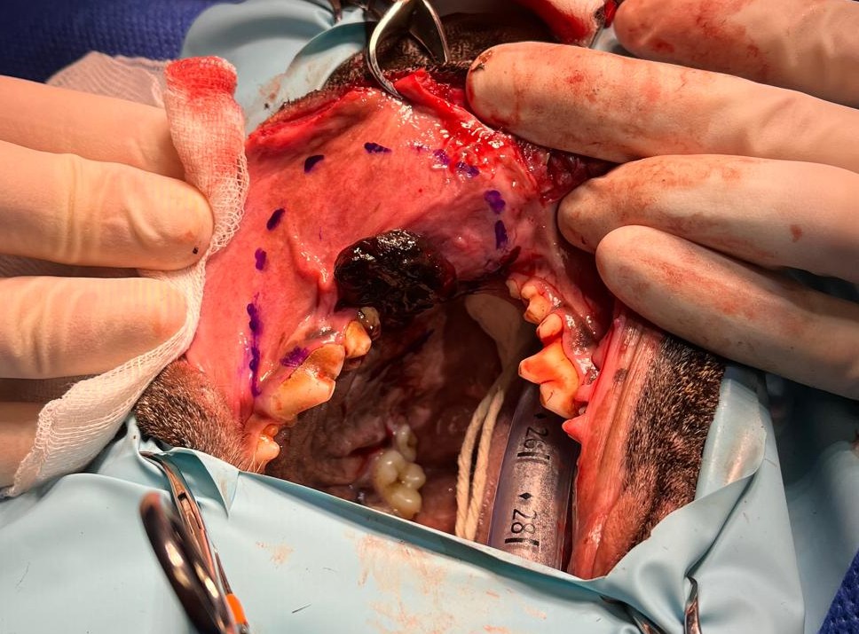 Caudal Maxillectomy case