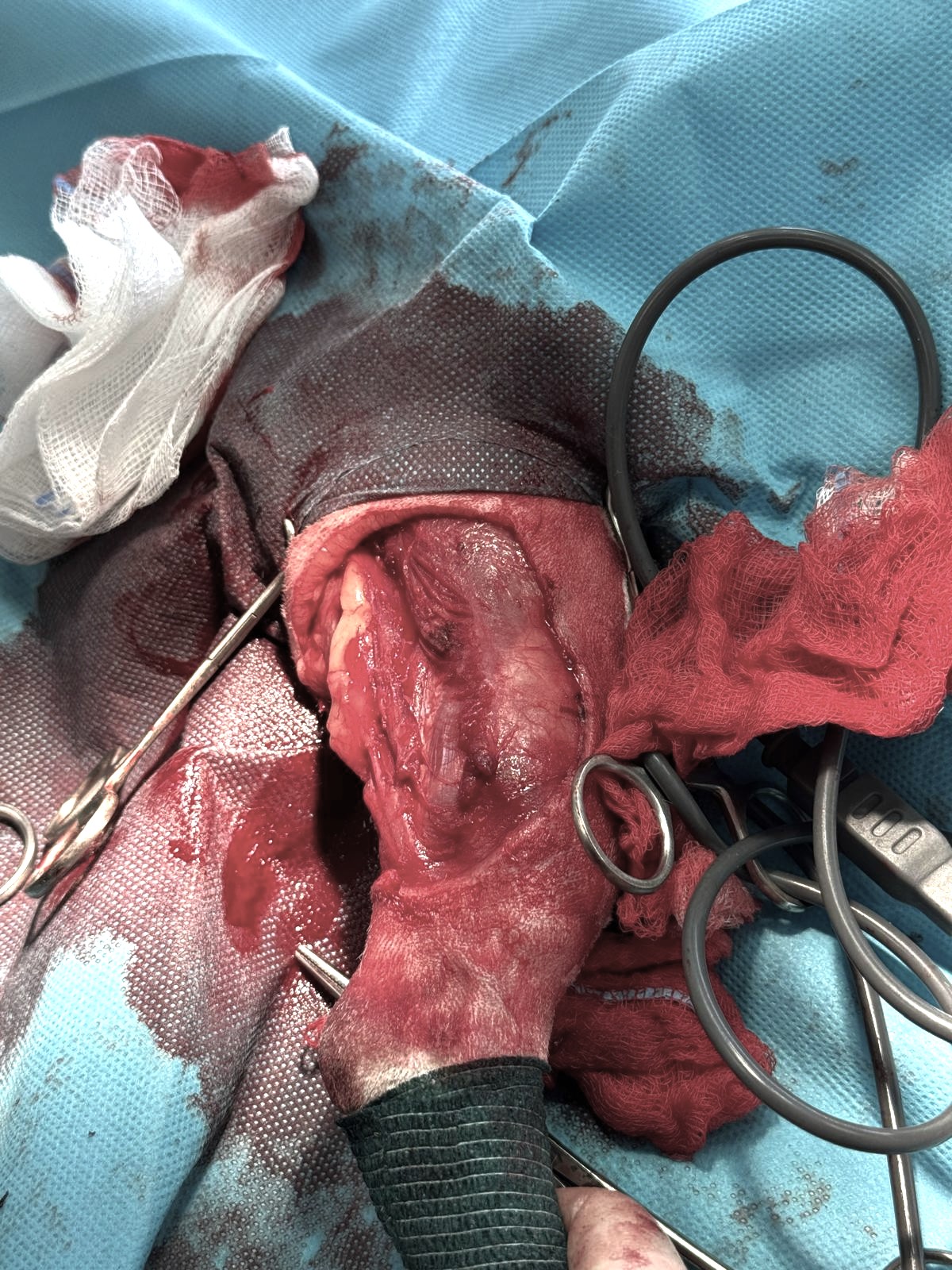Soft tissue surgery