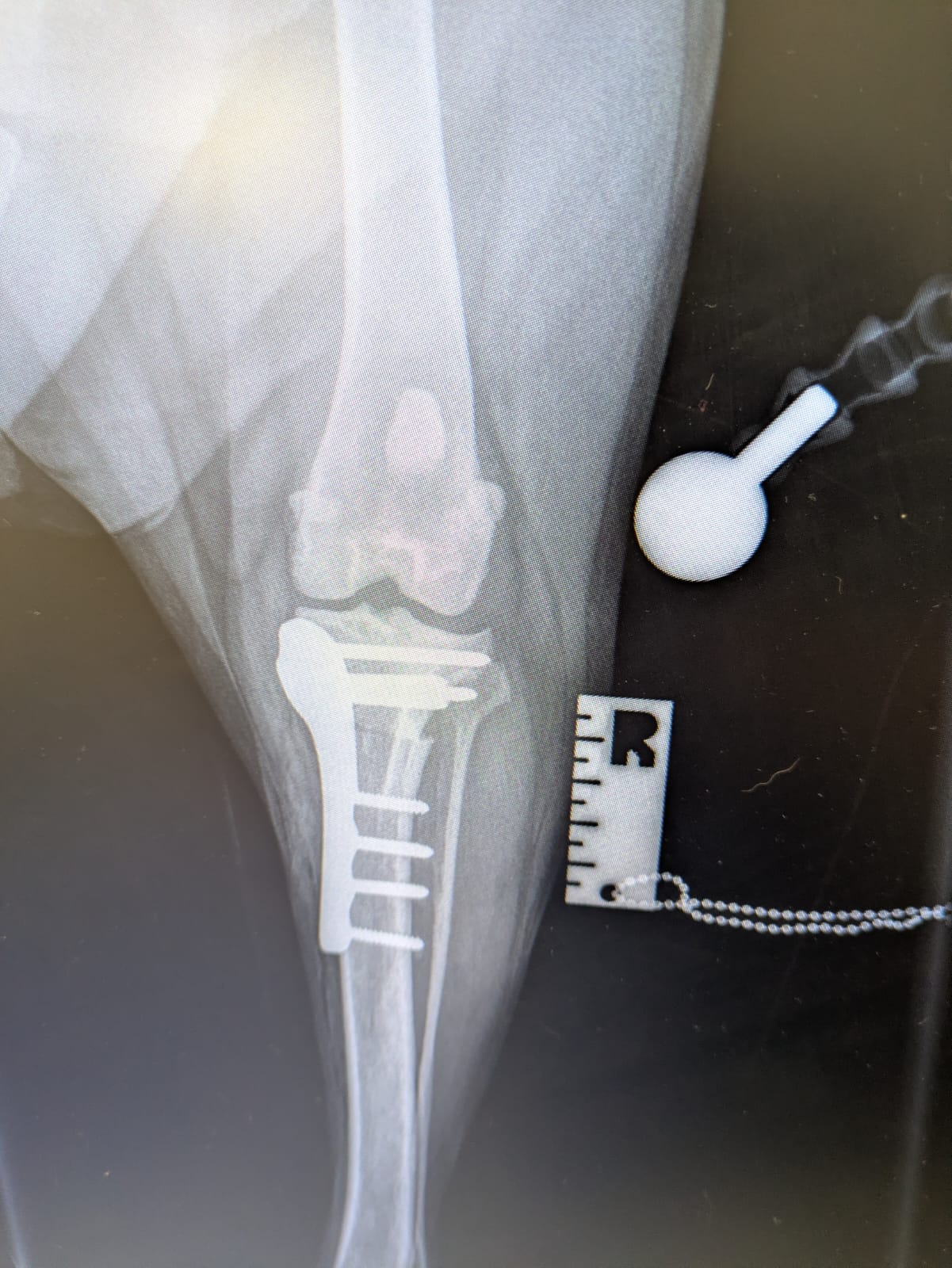 Orthopaedic surgery